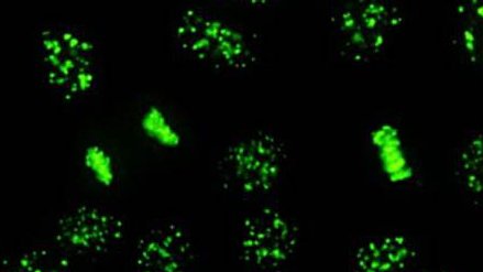 Immunfluoreszenz-Bild von positiven antinuklearen Antikörpern, typisch für Autoimmundermatosen.